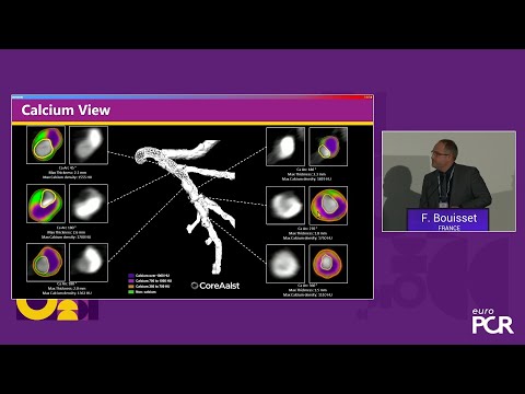 New perspectives in 3D calcium visualisation with CT and angiography for complex PCI - EuroPCR 2025